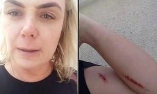 Vídeo mostra ex-paquita se machucando antes de acusar marido de agressão