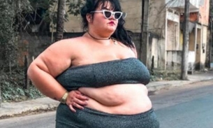  Após acidente, bailarina plus size volta a desabafar sobre falta de acessibilidade