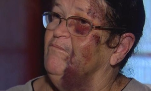 Motorista que arrastou vendedora de balões disse ter feito “brincadeira”