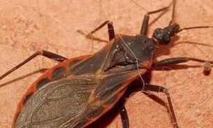 FVS confirma novo caso de Doença de Chagas no Amazonas