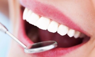 Especialista desvenda 5 mitos sobre a saúde bucal