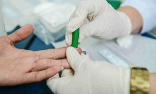  Campanha de luta contra Hepatites Virais é lançada no Amazonas