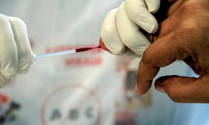 Ações de combate às hepatites virais são realizadas em Manaus