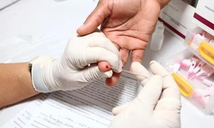 Testes gratuitos de hepatites virais serão realizados em Manaus 