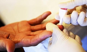 Dia Mundial de Luta Contra as Hepatites Virais é comemorado hoje