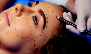 Harmonização facial: saiba quais são as três principais indicações do procedimento