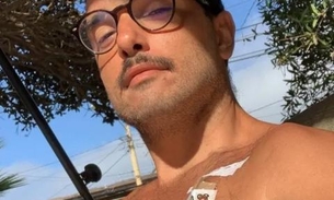 Léo Rosa inicia tratamento contra câncer após arrecadar R$ 140 mil em 'vaquinha' online