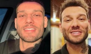 Lucas Lucco aparece com rosto diferente e é criticado por suposta harmonização facial