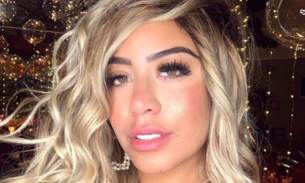 Rafaella Santos faz preenchimento labial e resultado choca seguidores; confira 