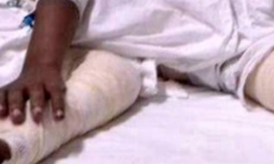 Avó é suspeita de jogar água quente em neto que não queria tomar banho