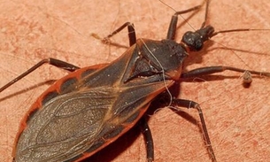 Dez casos da doença de chagas são confirmados no Amazonas 