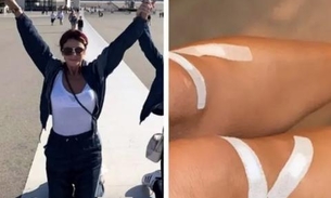 Giovanna Antonelli mostra foto do joelho após pagar promessa