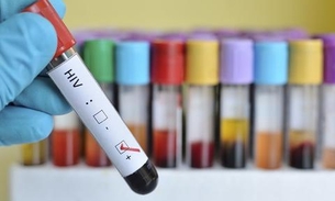 Pesquisa detalha distribuição dos subtipos do HIV no Brasil