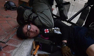 Incidente com estudante baleado pela polícia em Hong Kong gera revolta