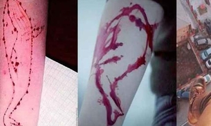 CCJ aprova tipificação do crime de induzir adolescentes a se automutilarem