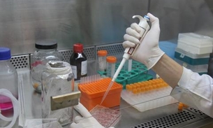 Concorrência pode reduzir custo de medicamentos biológicos