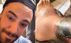 Felipe Titto tem infecção em perna após mordida de cachorro 
