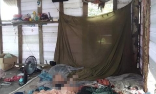 Criança de cinco anos é resgatada em estado de desnutrição e abandono no Amazonas