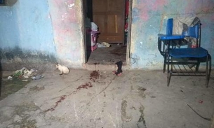 Sexta vítima de chacina em Manaus ainda luta pela vida em SPA