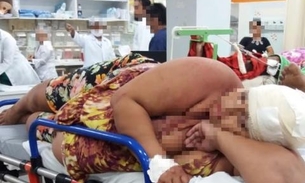 Grávida ferida em chacina está com bala alojada na cabeça em hospital de Manaus
