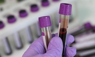 Paciente vítima de discriminação em UPA por ter HIV será indenizada