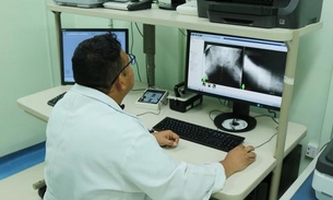 Em Manaus, FCecon volta a oferecer serviço de radioterapia interna