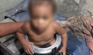 Bombeiros resgatam criança que ficou presa em panela de pressão