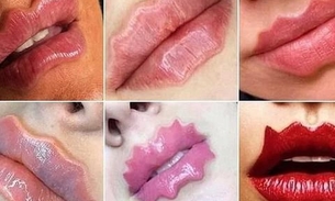 Lábios do Diabo: Cirurgião plástico faz alerta para nova tendência
