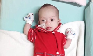 Bebê cardiopata que teve cirurgia adiada morre em hospital de Manaus 