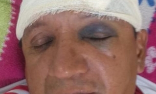 Em Manaus, vizinho irado invade loja e espanca dono com barra de ferro na frente dos filhos