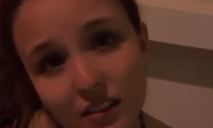 De férias, Larissa Manoela sofre queimadura na testa e vira piada: ‘Couro cabeçudo'