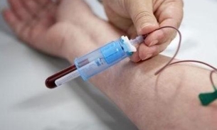 No Brasil, mais de 12 mil pessoas são diagnosticadas com hemofilia