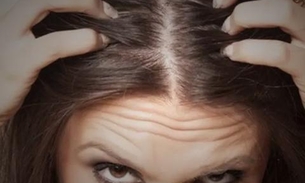 Veja mitos e verdades sobre queda de cabelo e fique atento