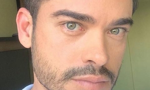 Sidney Sampaio viaja a Manaus para fazer transplante capilar