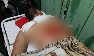  Durante confronto, cabo do Exército cai em rio e tem costas dilaceradas por hélice de barco