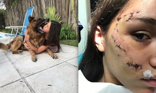 Cachorro morde rosto de jovem durante ensaio fotográfico  