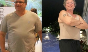 Diretor do BBB, Bonino faz cirurgia plástica após perder mais de 45 kg