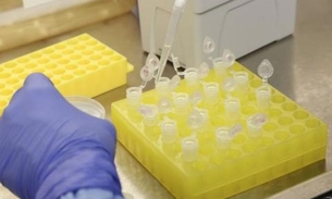 Médicos usam remédios contra HIV e ebola para tratar novo coronavírus