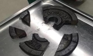 Homem é socorrido após ficar com o pênis preso em anilha de academia