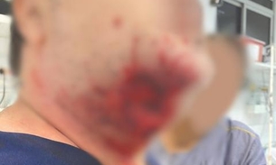 Paciente surta, arranca pedaço de rosto de médico com mordida e quebra portas de hospital