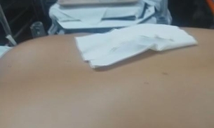 Paciente com faca cravada nas costas esperou 44 h por cirurgia em rede pública 