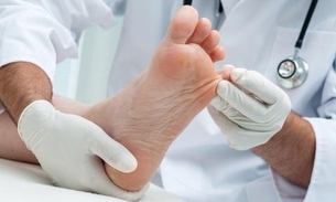 Município ganha reforço no combate ao pé diabético em Manaus