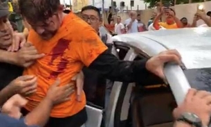 Vídeo: Cid Gomes é baleado ao tentar furar bloqueio policial com retroescavadeira