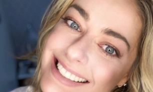 Após acidente, vencedora do MasterChef fica com rosto desfigurado e desabafa na web