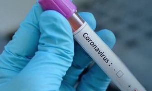 Brasil se torna o primeiro país da América Latina a confirmar caso de Coronavírus 