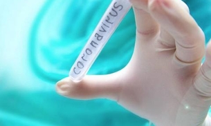 Sobe para 182 o número de casos suspeitos de coronavírus no Brasil