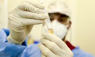 Genoma do vírus que infectou brasileiro é sequenciado em SP