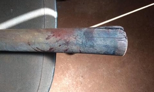 Inconsciente, jovem vai parar em hospital após levar paulada de esposa em Manaus