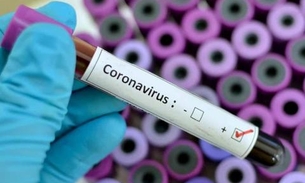 Anvisa: Não há evidências de falta de medicamentos por causa do coronavírus