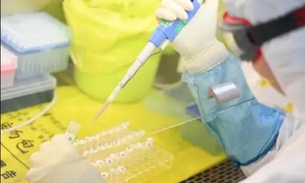 Cientistas chineses descobrem dois tipos principais do novo coronavírus